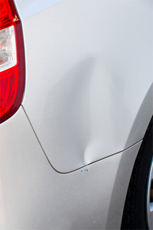 Dent.jpg